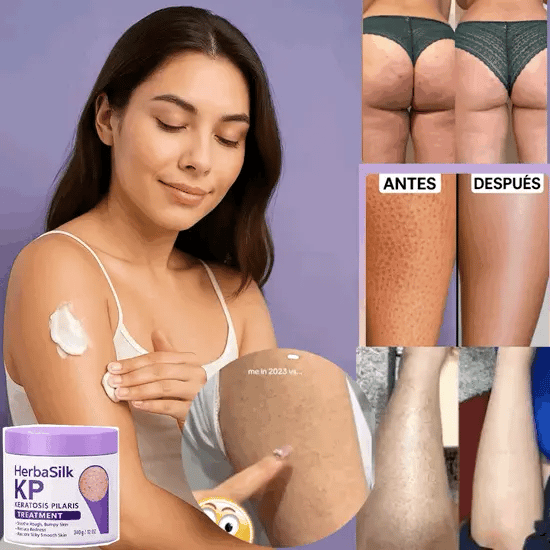 ✨ HerbaSilk KP™ 🔥Crema avanzada - Envío Gratis
