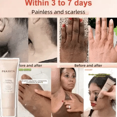 Crema especial despigmentante🎁𝗥𝗲𝘀𝘁𝗮𝘂𝗿𝗮 𝗤𝗞 & 𝗖𝘂𝗮𝗹𝗾𝘂𝗶𝗲𝗿 𝗭𝗼𝗻𝗮𝘀 𝗢𝘀𝗰𝘂𝗿𝗮𝘀