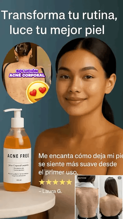 Gel Granos fórmula efectiva✨para la QK & Despigmentador 😍